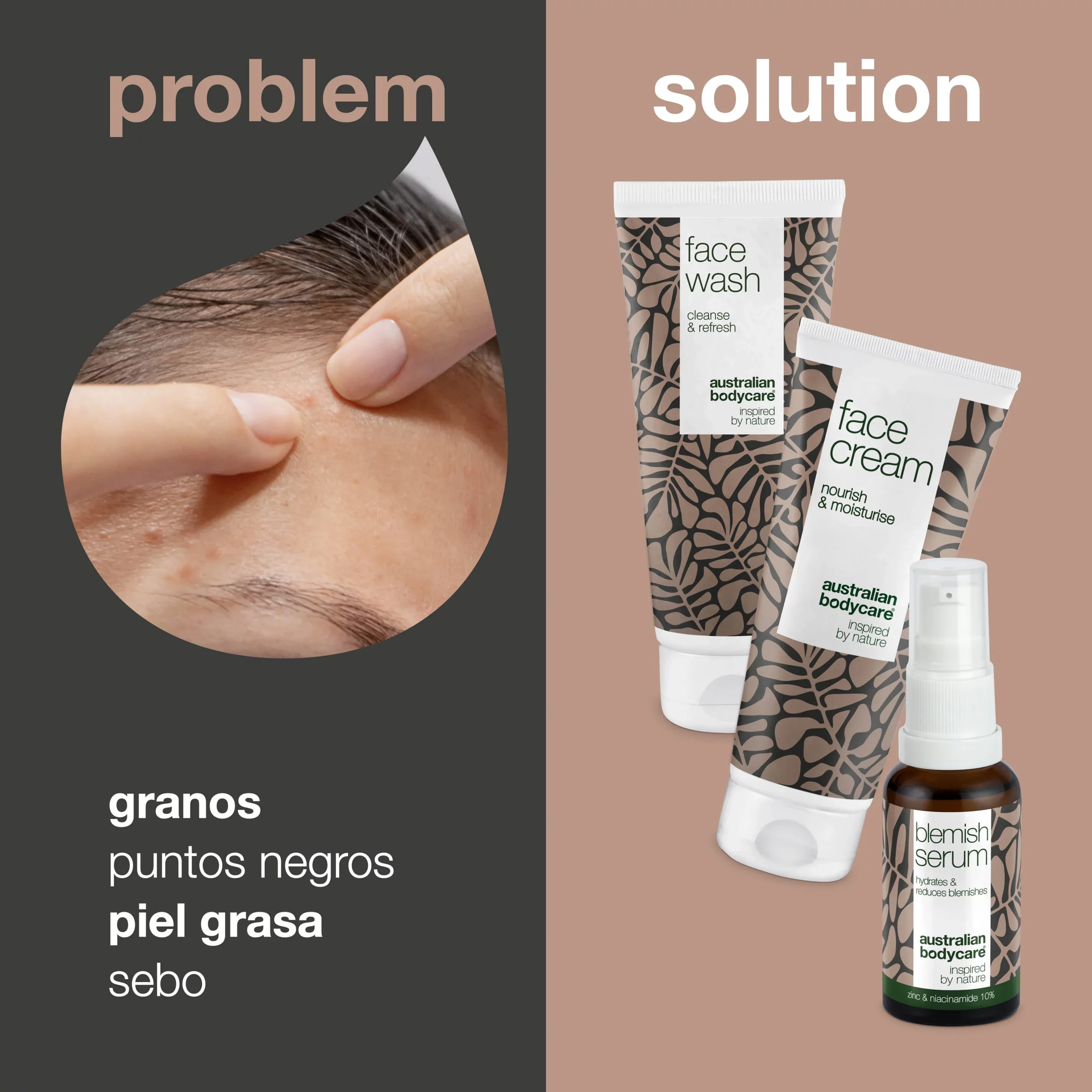 Set para espinillas y granos — 3 productos para el cuidado diario del acné y la piel grasa - Imagen 2